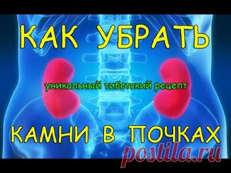 Камни в почках. Уникальный тибетский рецепт.