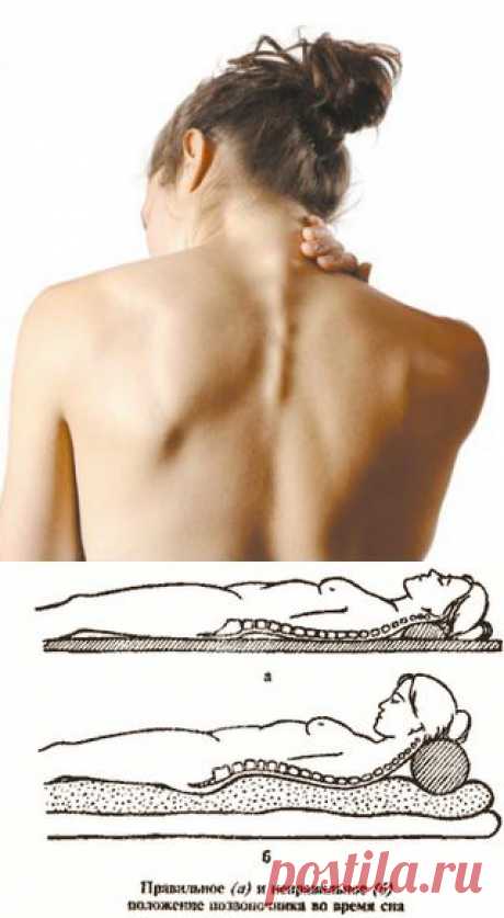 Как лечить шейный остеохондроз? Гимнастика