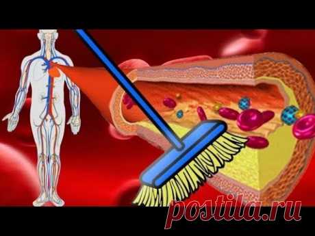 Как Очистить Сосуды И Нормализовать давление в домашних условиях ? — Мой личный опыт