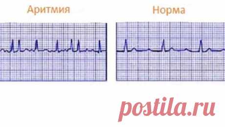 Пять простых способов успокоить сердце при аритмии - Образованная Сова