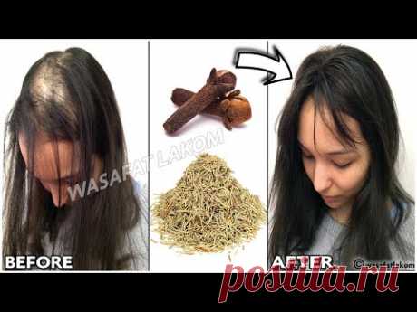 Индийский секрет 🌿 для ускорения роста волос и лечения облысения с первой недели.