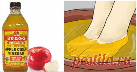 Невероятные полезные свойства яблочного уксуса