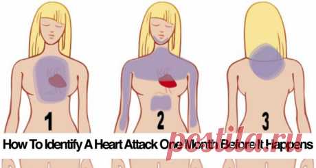 Here's How To Identify A Heart Attack One Month Before It Happens