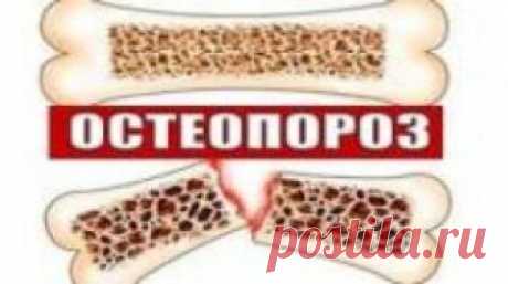 Профилактика остеопороза: питание, физическая нагрузка | Советы целительницы