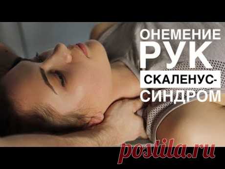 Онемение рук - скаленус синдром