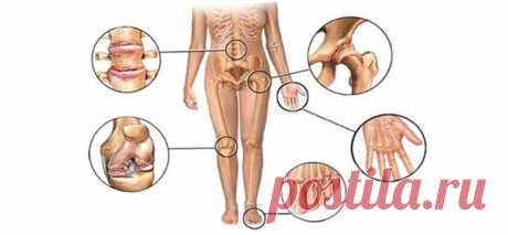 Как позаботиться о суставах | Путь к здоровью | Яндекс Дзен