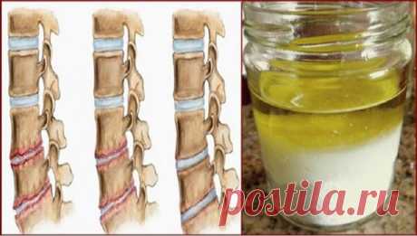 Попробуйте эту смесь — и избавитесь от боли, мучившей вас много лет!