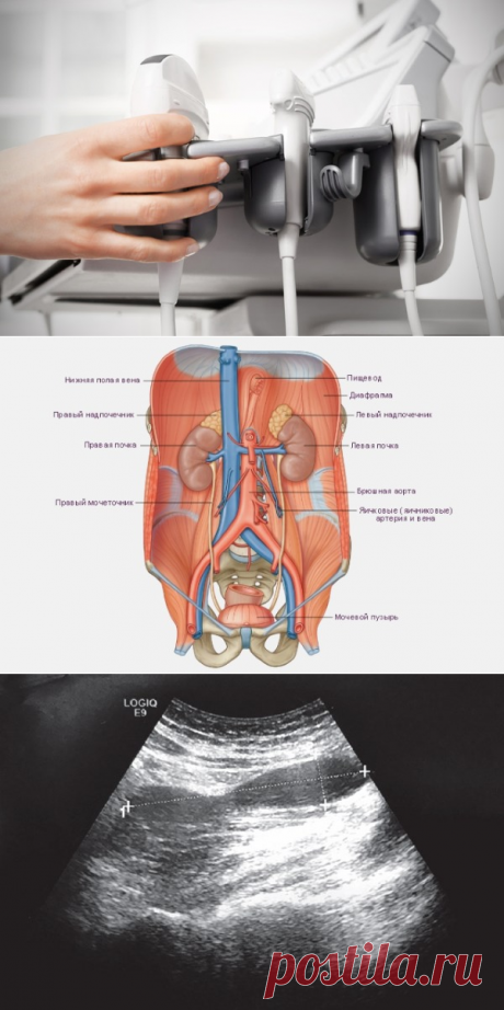 Что входит в УЗИ забрюшинного пространства: подготовка, показания, расшифровка, стоимость