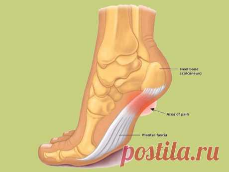 Пяточная шпора: Что делать? Время от времени боль в пятке испытывает как минимум один человек из десяти. 
Причины неприятных ощущений бывают разными. 
Однако сильная, резкая боль в пятке чаще всего является симптомом плантарного…
