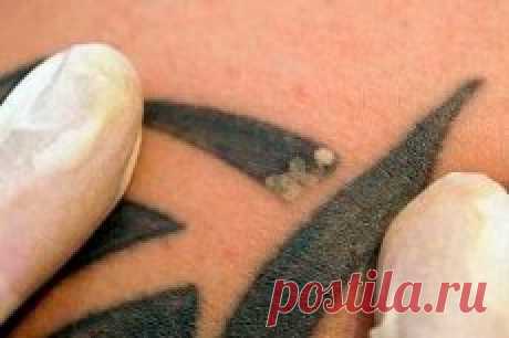 Татуировки опасны для здоровья | Компетентно о здоровье на iLive