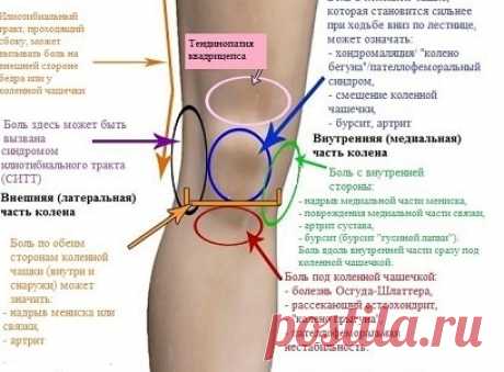 Почему болят суставы: причины