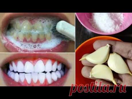 Отбеливание зубов в домашних условиях за 2 минуты ||  Как естественным образом отбелить желтые зубы
