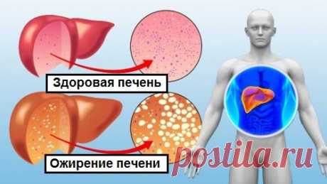 10 продуктов, которые можно включить в диету, чтобы очистить печень