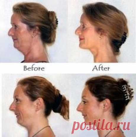 Tone double chin and get a defined jawline with face…