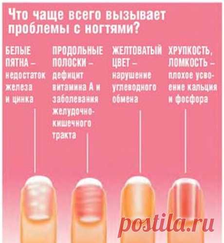 белые пятна на ногтях пальцев рук причина у женщин: 11 тыс изображений найдено в Яндекс.Картинках