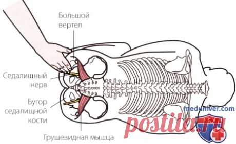 Пальпация пояснично-крестцового отдела позвоночника в положении лежа на боку