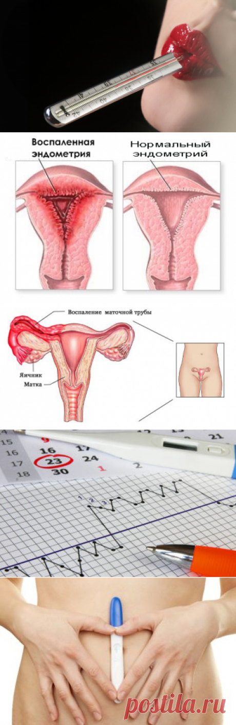 Температура перед месячными: может ли повышаться?