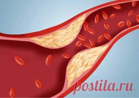 Советы врачей по быстрому снижению холестерина в крови | здоровье и спорт | Яндекс Дзен