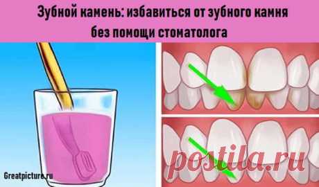 Зубной камень: избавиться от зубного камня без помощи стоматолога Зубной камень: избавиться от зубного камня без помощи стоматолога.Попробуйте сами.Как правило, стоматолог удаляет зубной камень, с которым не