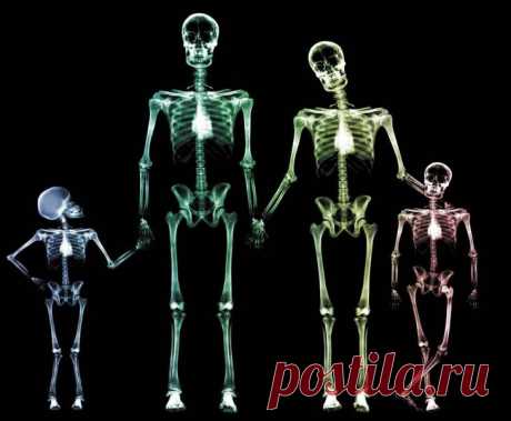 Доброкачественные опухоли костей.... Казалось бы, кости, скелет - самая прочная составляющая человеческого организма. Но на самом деле костная ткань также подвержена заболеваниям, как и любая другая. Доброкачественные опухоли костей - одна из проблем, которая может появиться в любом возрасте...