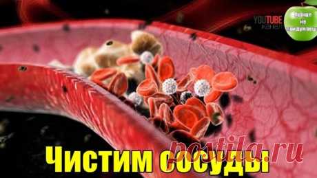 Чистка сосудов медом, луком и чесноком. Проще не придумаешь!!!