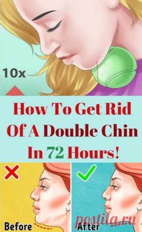 The awful layer of subcutaneous fat around the neck which sags down and creates wrinkles makes you feel like you have a second chin. Everyone who has it feels annoyed, and try to hide it by wearing scarf or a high neck top.