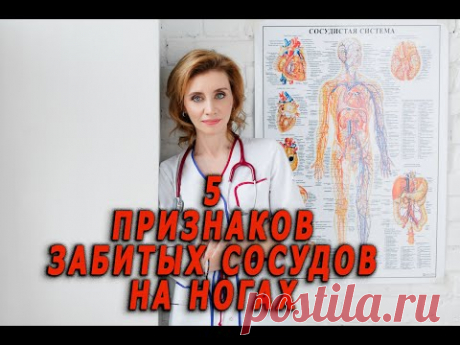 5 признаков забитых сосудов ног. Кардиолог. Анна Кореневич