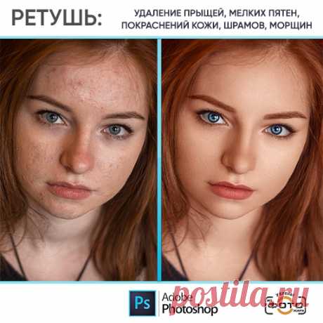 фотографии до и после обработки: 9 тыс изображений найдено в Яндекс Картинках