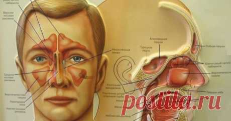 Полезные советы: Как почистить пазухи носа и избавить себя от многих недугов