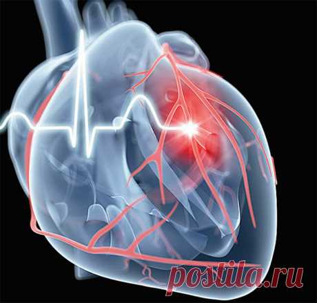 Психосоматика инфаркта миокарда | Все о Любви к Жизни | Яндекс Дзен