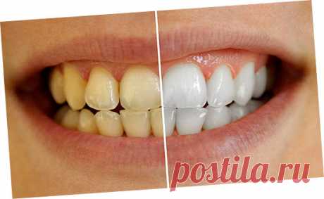 Белоснежные зубы без похода к стоматологу? Легко! | ЛайкСовет | Яндекс Дзен