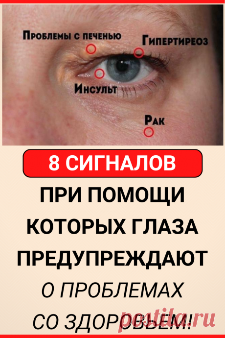 8 сигналов, при помощи которых глаза предупреждают о проблемах со здоровьем! Обрати внимание!
#здоровье #глаза #зрение #диагностика #симптомы