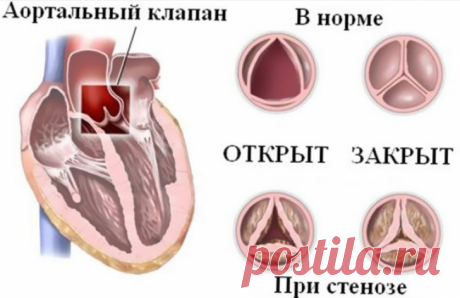 Как болит сердце: основные причины и симптомы боли в сердце