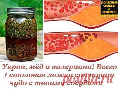 Укроп, мёд и валериана! Всего 1 столовая ложка сотворит чудо с твоими сосудами.
К сожалению, наши кровеносные сосуды имеют свойство загрязняться. Они накапливают на своих стенках отложения неорганических солей, что в дальнейшем является причиной развития атеросклероза, нарушения кровообращения, повышенного давления и варикоза.
Поэтому рекомендуется регулярно проводить курс очищения кровеносной системы. Сегодня наша редакция поделится с тобой проверенным методом очищения со...