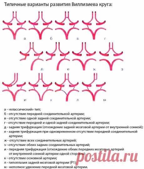 Виллизиев круг: анатомия, варианты развития, патология