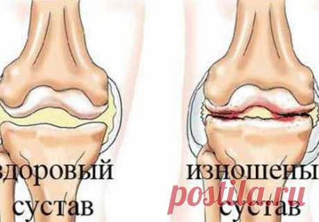 Отличный рецепт от боли в суставах