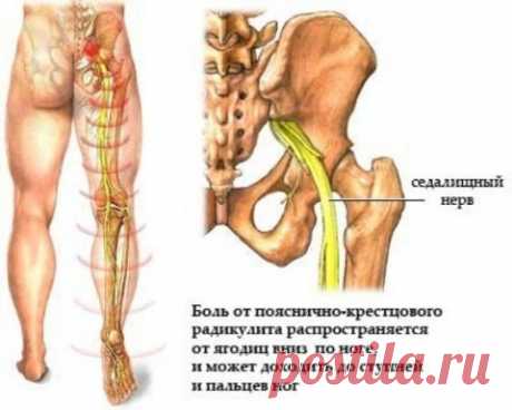 ПЕРВАЯ ПОМОЩЬ И НЕСКОЛЬКО НЕХИТРЫХ ПРАВИЛ ПРИ &quot;ПРОСТРЕЛЕ&quot;