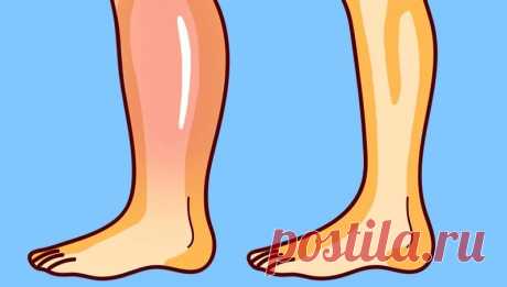 Рекомендация остеопата: 3 простейших упражнения от отека ног Отечность ног — это не только следствие «стоячей» работы, как считают многие обыватели. Часто за отеками нижних конечностей кроются белее серьезные причины. Например, проблемы со здоровьем. Вот как...