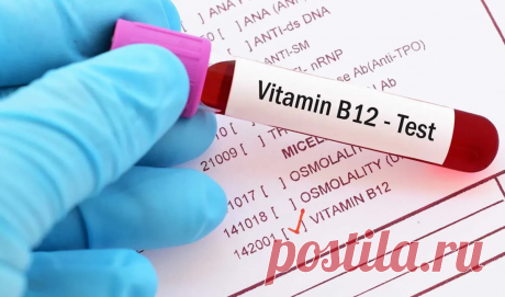 Дефицит витамина В12 – чем опасен, как заметить и исправить | ЛДЦ «Кутузовский» | Яндекс Дзен