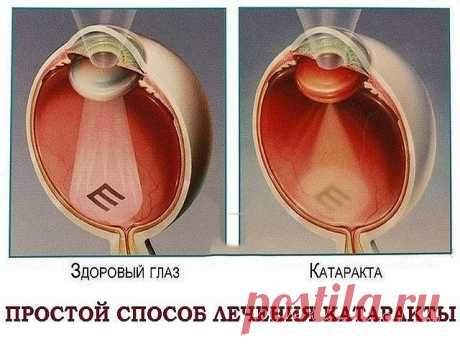 (68) Одноклассники