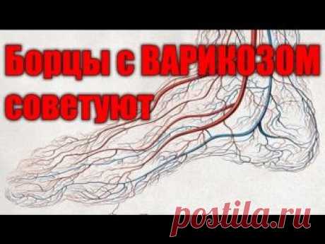 Варикоз лечится элементарно, если знаешь рецепт этой мази! - Страница 2 из 2