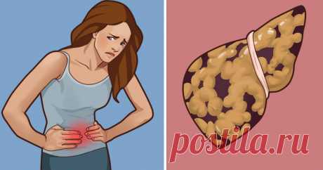 Хотите узнать, есть ли у вас жировая болезнь печени? Вот ее основные симптомы . Милая Я