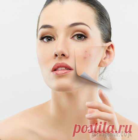 Как убрать шрамы от угревой сыпи на коже лица?