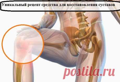 Всё самое интересное!: Уникальный рецепт восстановления подвижности суставов