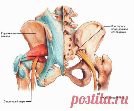 Как можно уменьшить боль и вылечить седалищный нерв