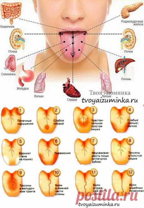 ЯЗЫК СКАЖЕТ О ТЕБЕ !!!  **Наш язык -простейшая диагностика заболеваний. Цвет, размер и кожа языка -это индикаторы здоровья.
