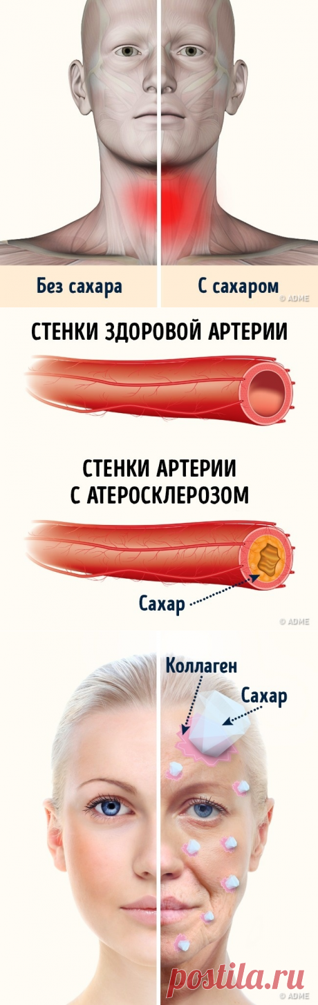 4 опасных свойства сахара, о которых мы не подозревали