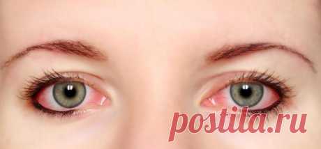 Красные капилляры в глазах: причины появления, лечение и профилактика
