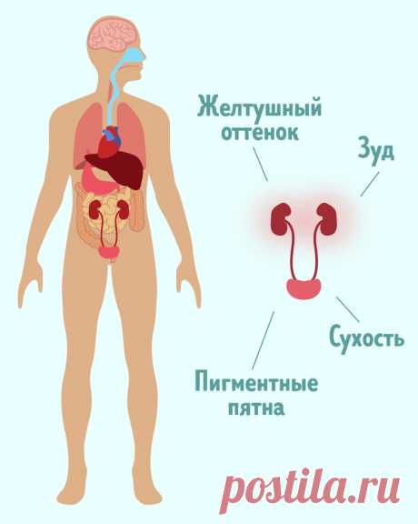 9 неочевидных симптомов, которые говорят о том, что с почками что-то не в порядке 
Большинство заболеваний почек может протекать без симптомов, что приводит к их позднему выявлению и даже переходу в разряд хронических. Различные недуги, связанные с почками, поражают до 14 % взросло…