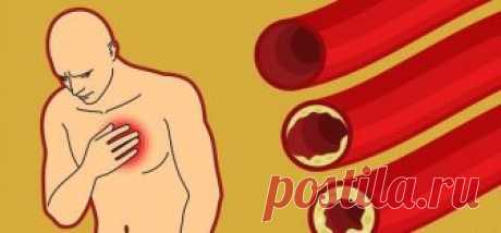 9 продуктов, которые естественным способом очищают артерии  

Ухудшение состояния артерий является причиной нарушения нормального кровоснабжения жизненно важных органов. Атеросклероз – патологическое состояние, при котором на стенках артерий формируются так н…